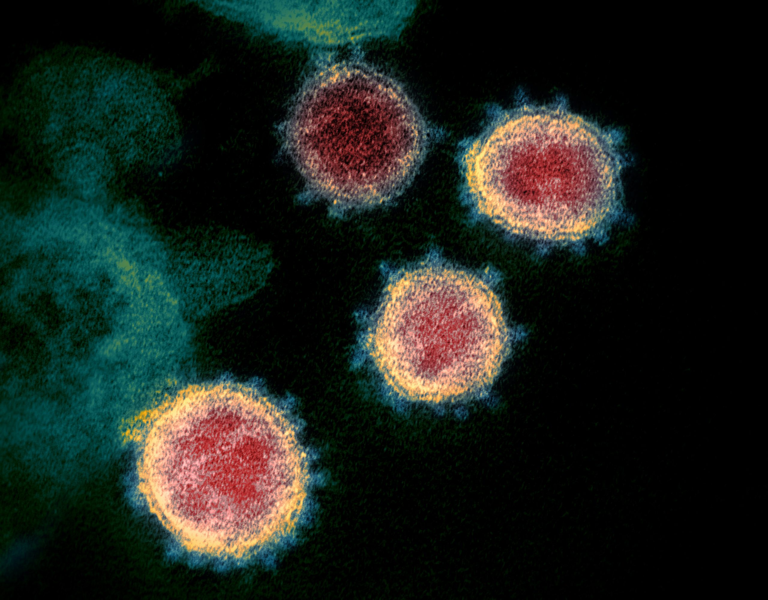 Coronavirus.Uy: cinco lecciones a casi dos años de pandemia